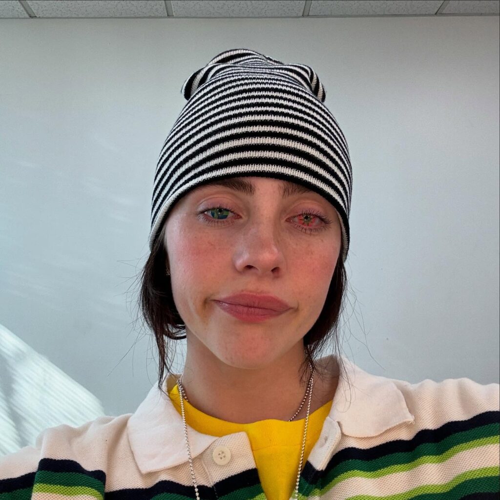 Billie Eilish Biography 2026: Age, Height, Net Worth & More